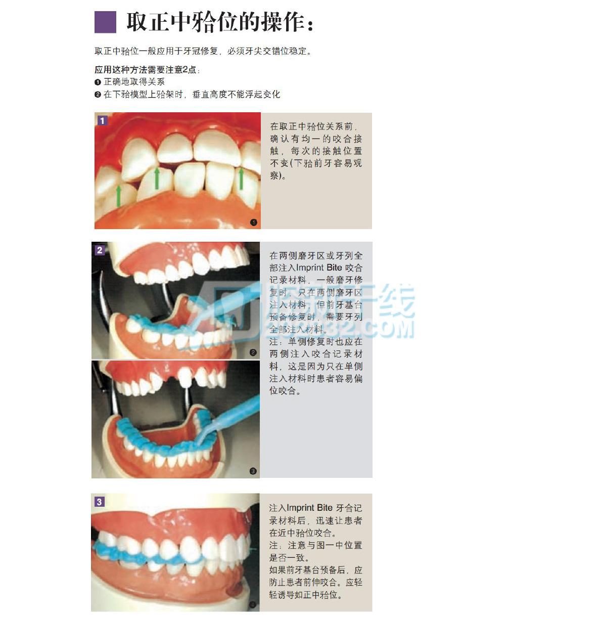 3M ESPE Imprint™ Bite加聚硅橡胶咬合记录材料 基质催化剂50mL-4.jpg