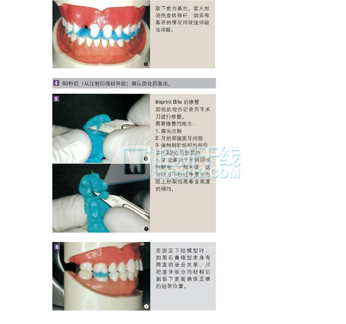 3M ESPE Imprint™ Bite加聚硅橡胶咬合记录材料 基质催化剂50mL-5.jpg