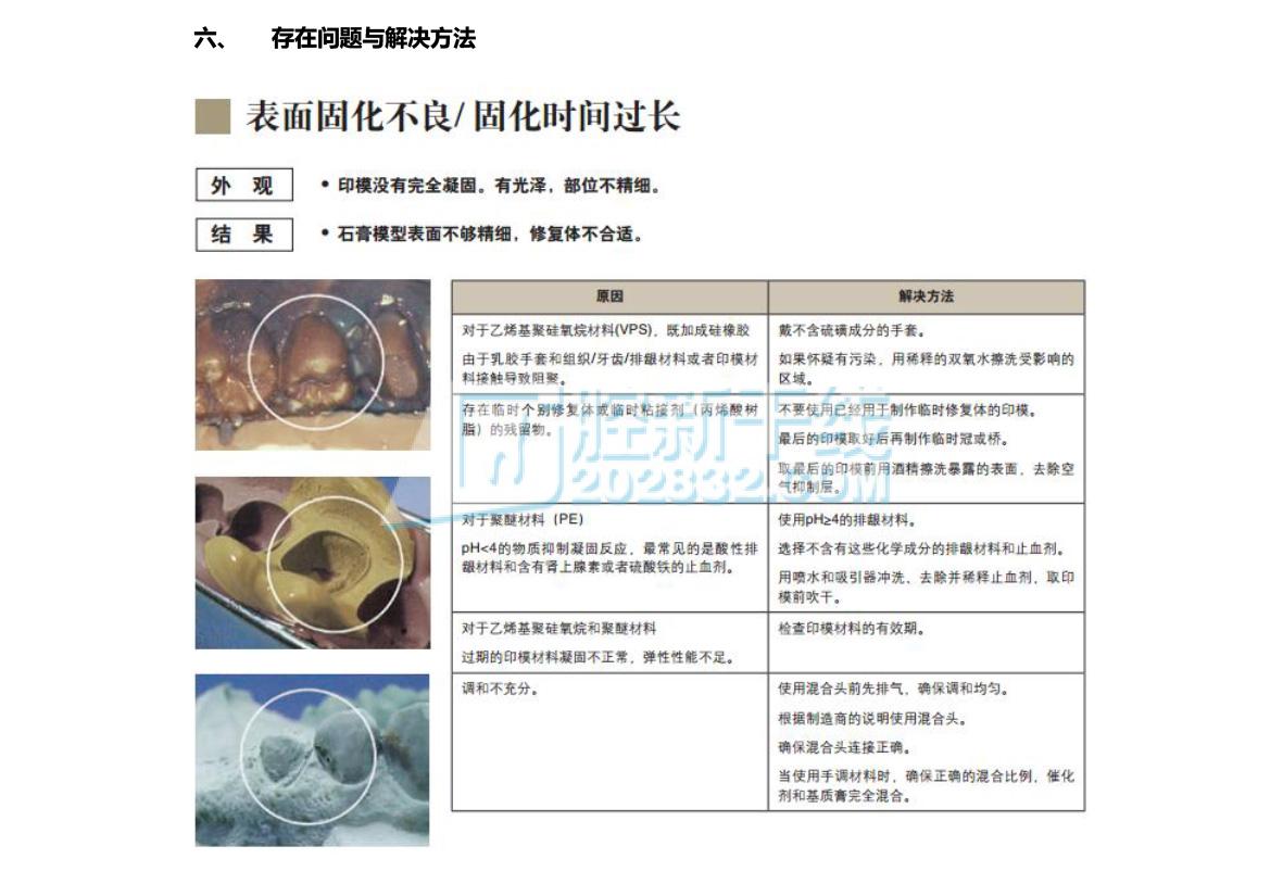 3M ESPE 聚醚精细印模材料软质高流动度聚醚枪混补充装-6.jpg