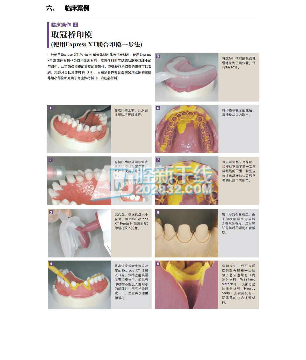 3M ESPE Express™XT Penta™ H 亲水加聚硅橡胶印模材-7.jpg