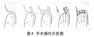 图5.png