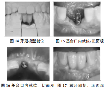 图14，15,16,17.png