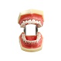 牙周病模型 M4023