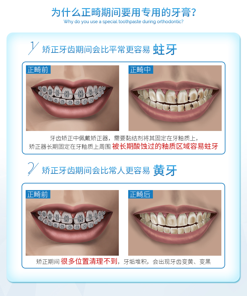 inside_正畸牙膏（新版内页1）_02-1576220551771.jpg