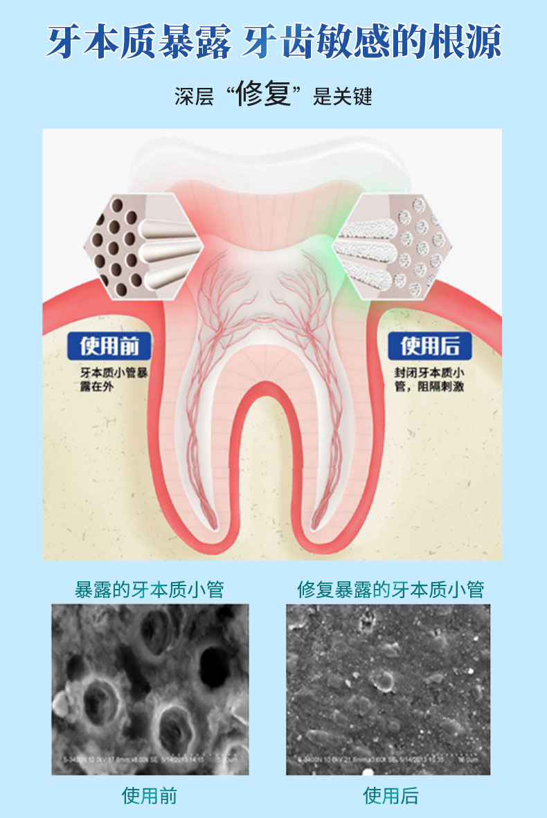 19685525963713324 脱敏剂详情页_03.jpg