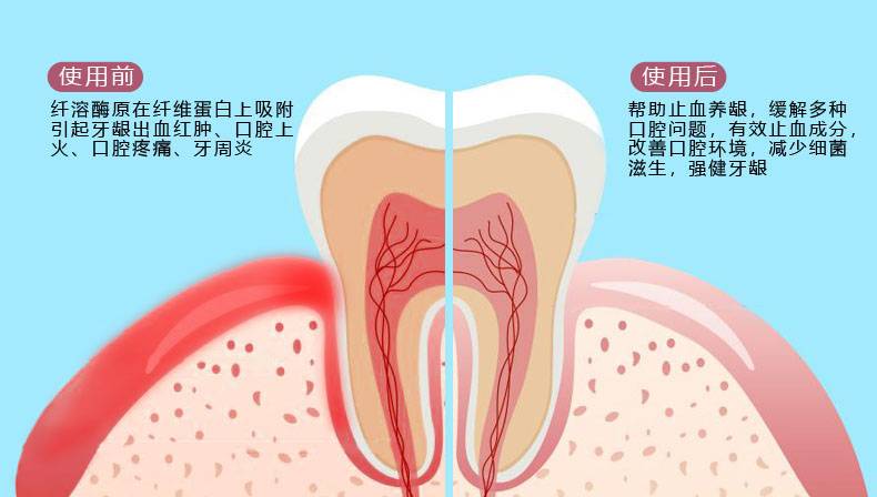ceb88ab6439a2e5f.jpg