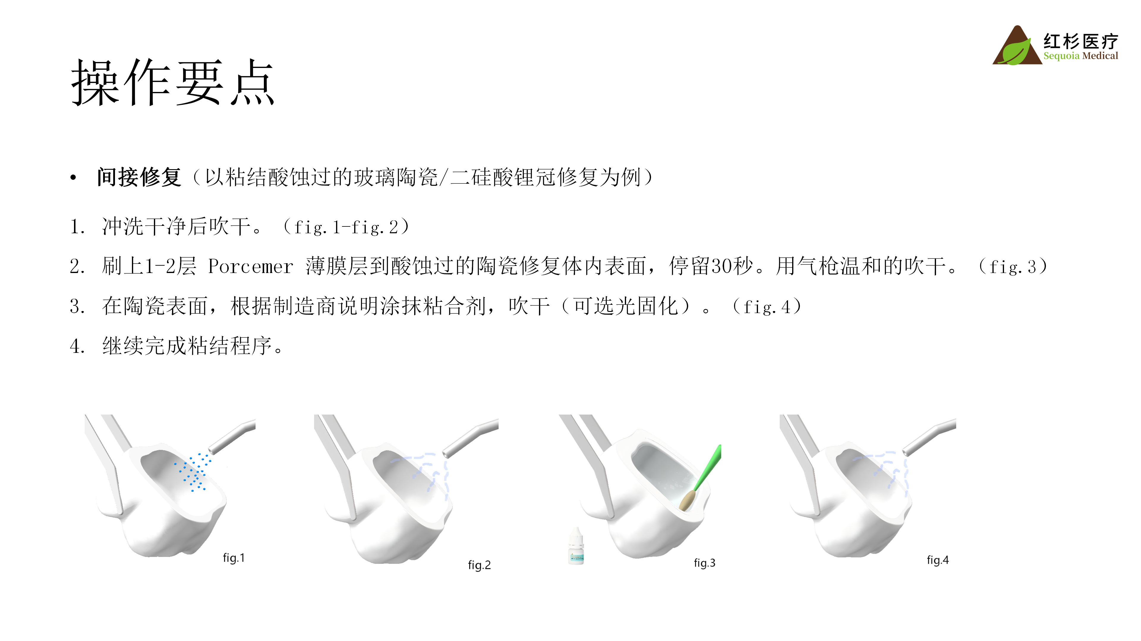 5493336300041731 预处理剂介绍_06.png