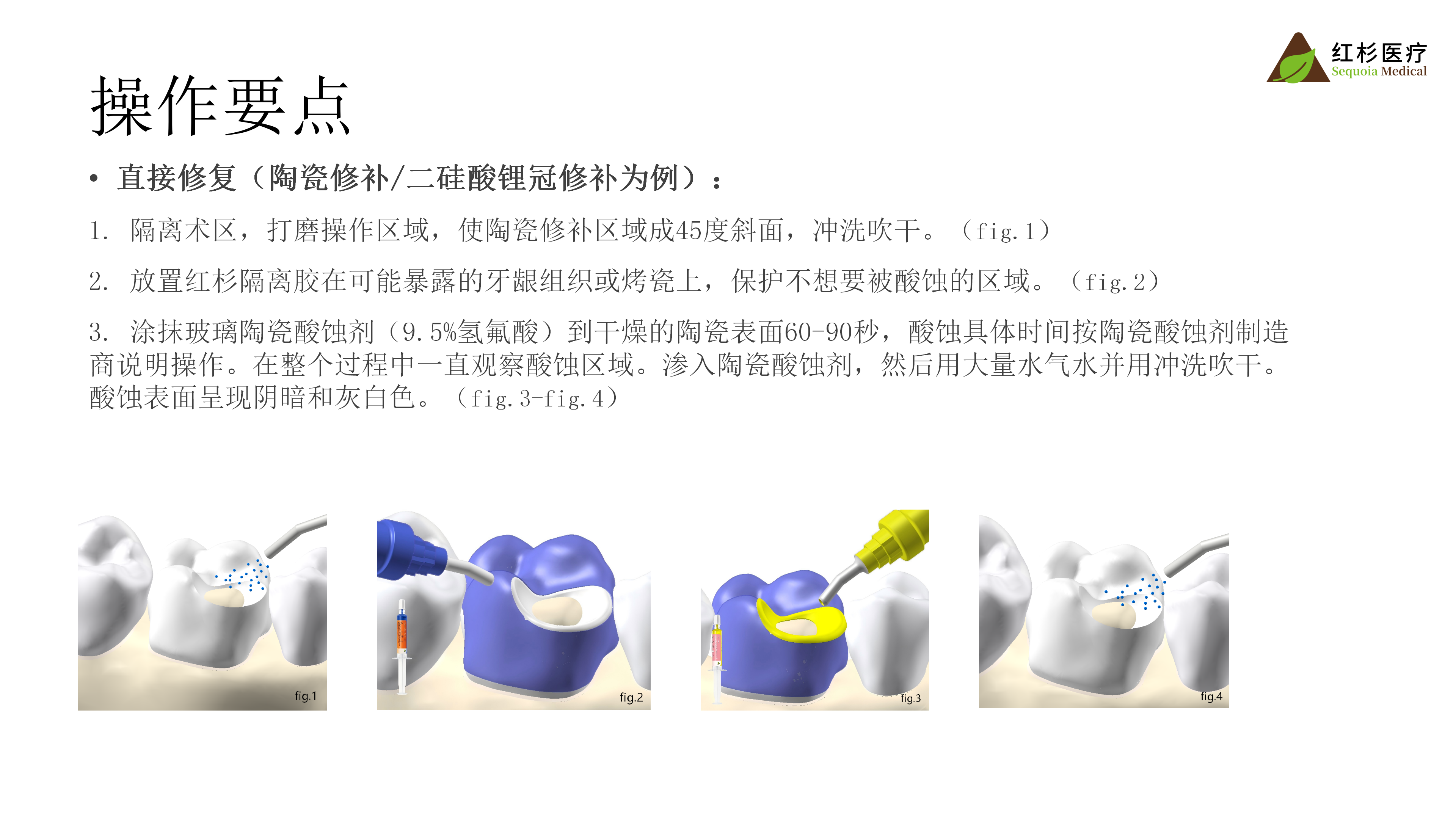 1083381319461063 预处理剂介绍_07.png