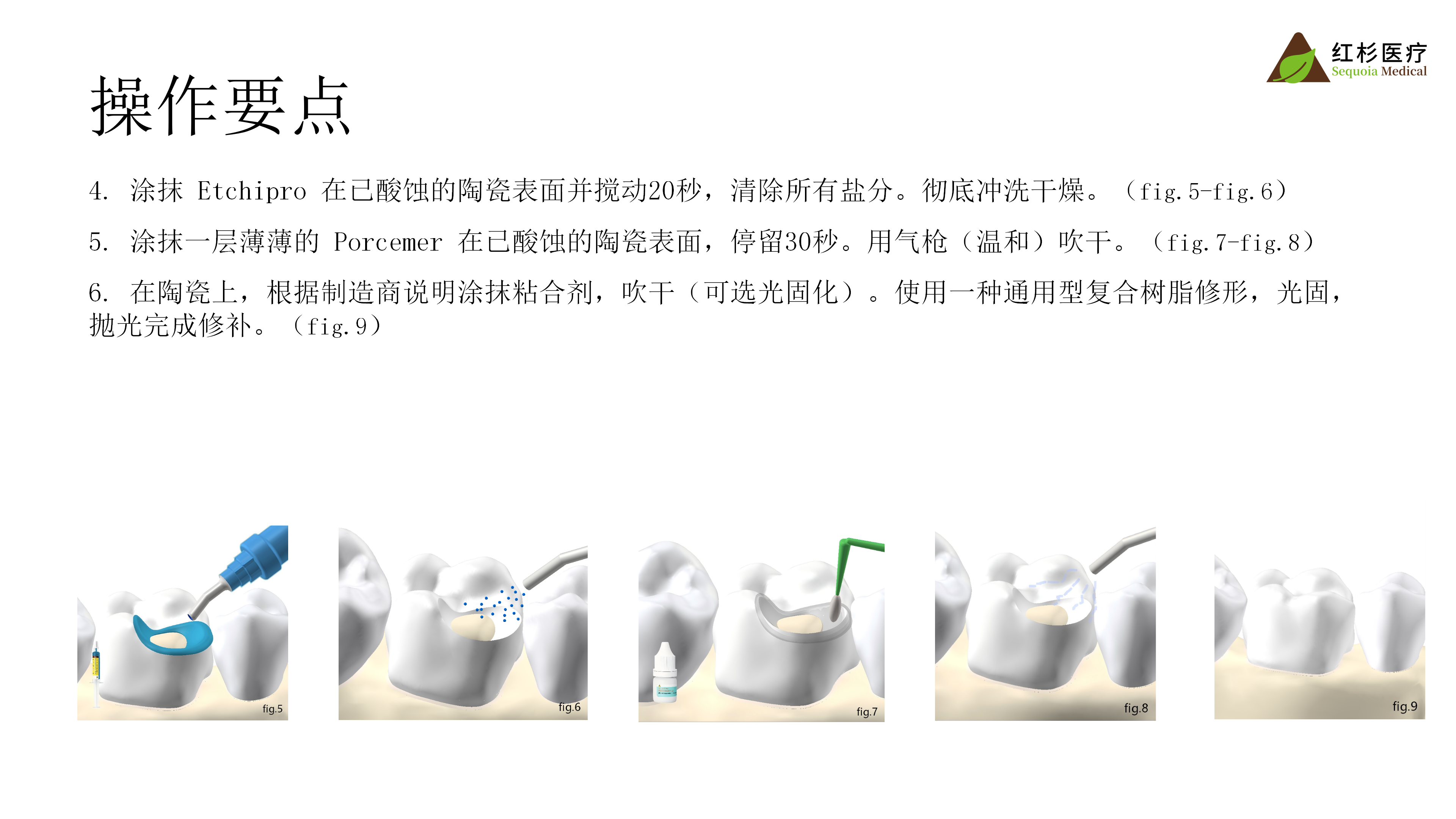 5629675707436941 预处理剂介绍_08.png