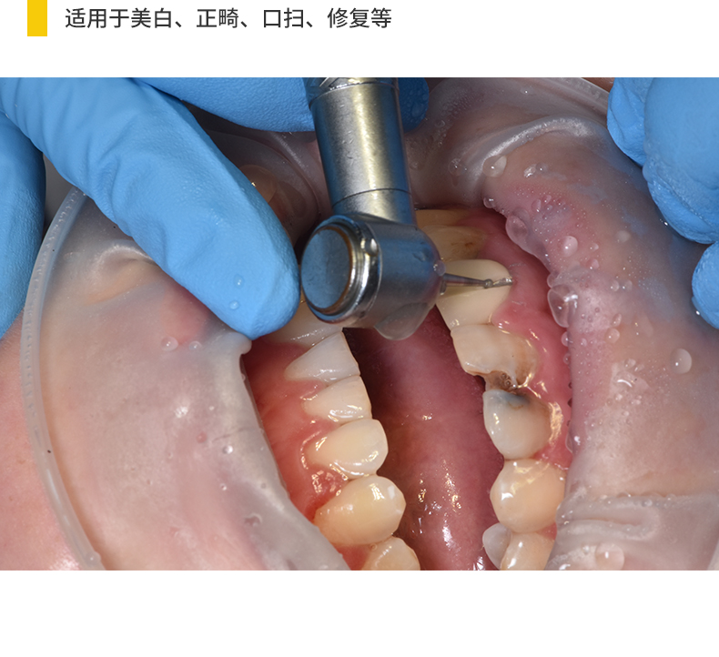 2412418116830197 开口器1_05.jpg